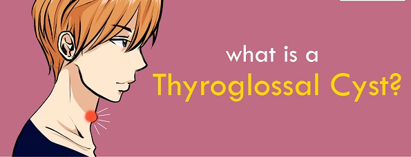 thyreoglossal 4