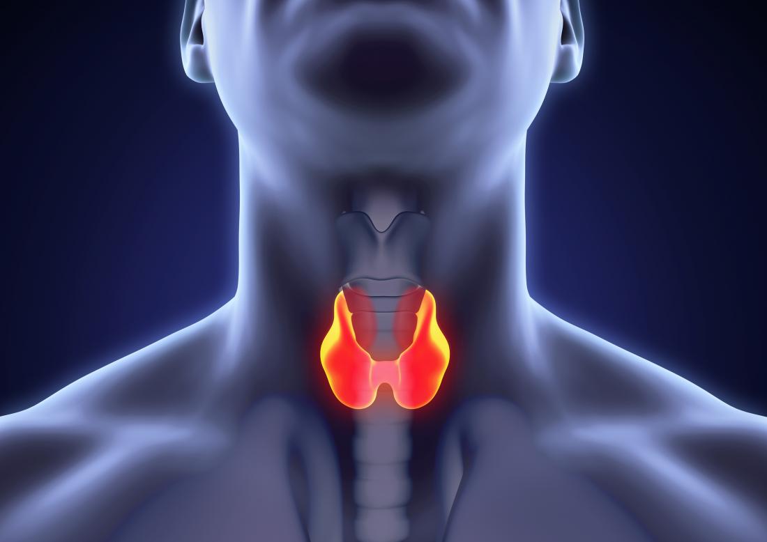 thyroiditis 4