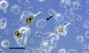 Ureaplasma 1