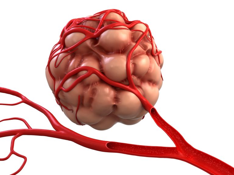 Η αγγειογένεση στον καρκίνο