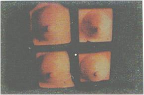 3ος-2ος αιώνας π.Χ., Ασκληπιείο  Κορίνθου