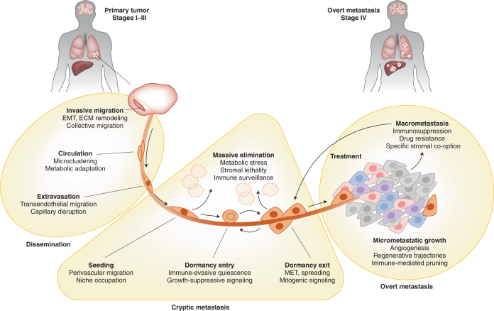 metastasis-2
