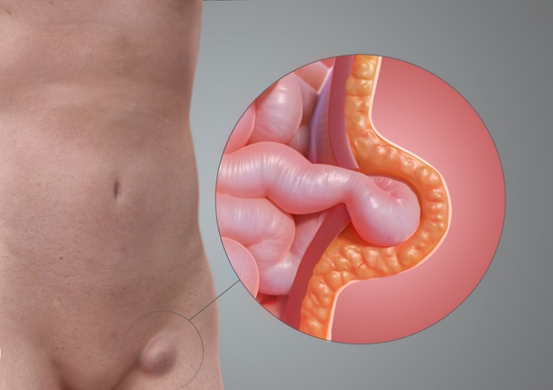 Αυτή η εικόνα δεν έχει ιδιότητα alt. Το όνομα του αρχείου είναι 5-18.jpg