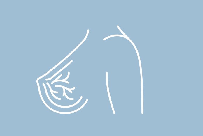 history-breast-cancer-4