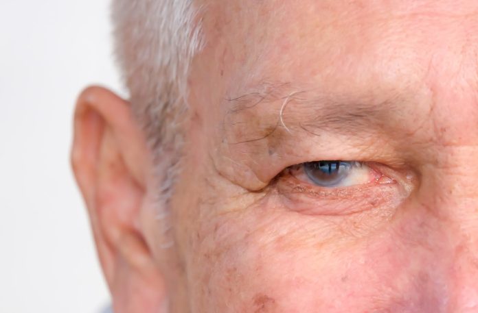 man-with-glaucoma