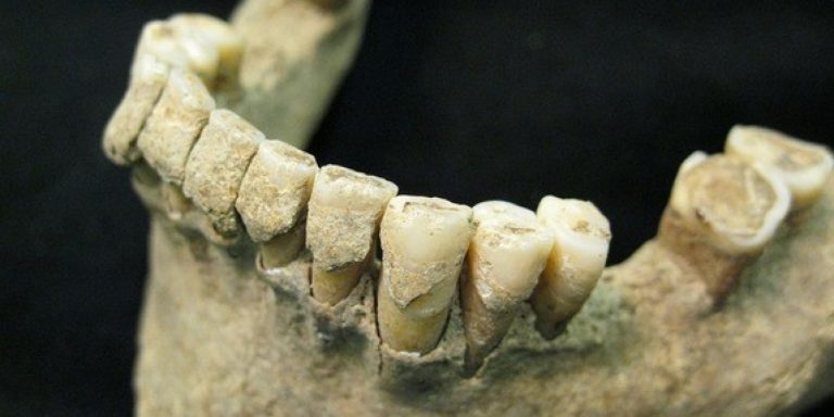 Οδοντιατρική στην αρχαία Αίγυπτο
