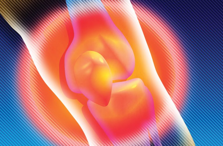 Τι να κάνετε αν σας πονάει μια άρθρωση