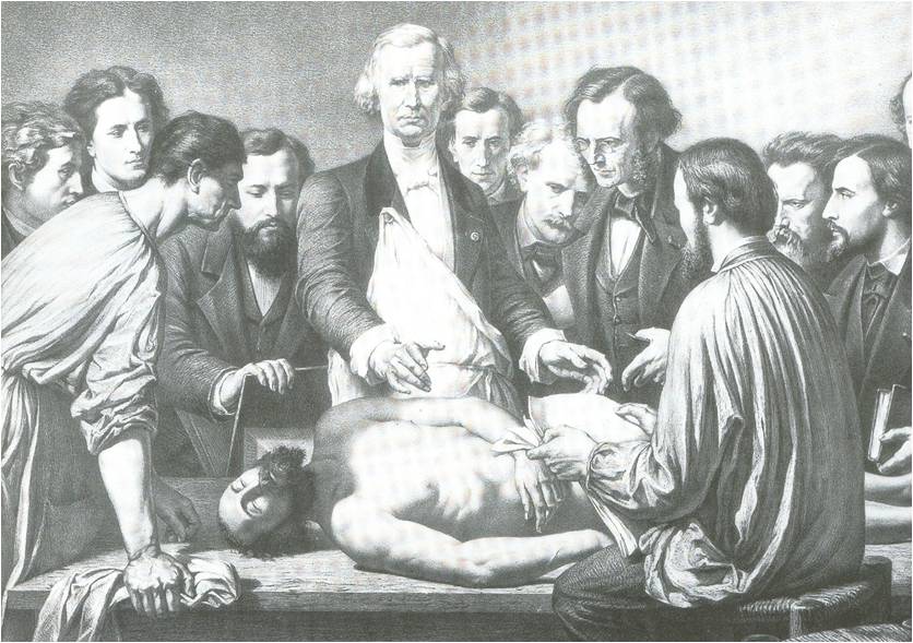 Mάθημα από τον Alfred Velpeau,   λιθογραφία από τον Louis Eugéne Pirodon,  περίπου το 1865