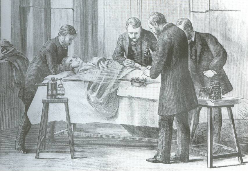 Άσηπτη χειρουργική σύμφωνα με τις αρχές του Lister, Antiseptic Surgery W. Watson Cheyne’s, (London, 1882)