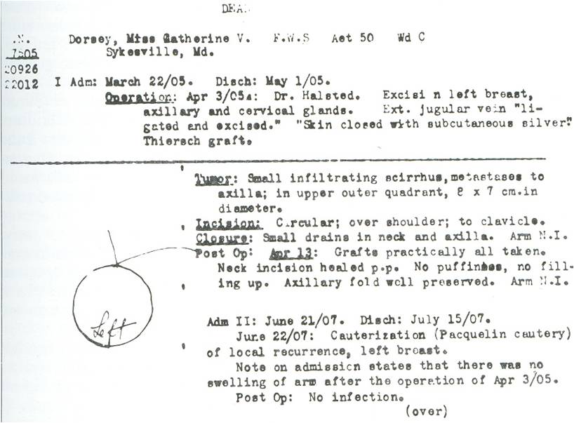 Καρτέλλα ασθενούς με καρκίνο του μαστού και ακόλουθη μαστεκτομή συμπληρωμένη από τον Halsted