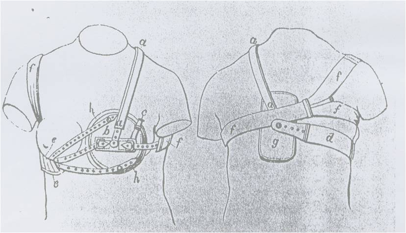 Mηχανισμός πίεσης που σχεδιάστηκε από τον Νeil Arnott