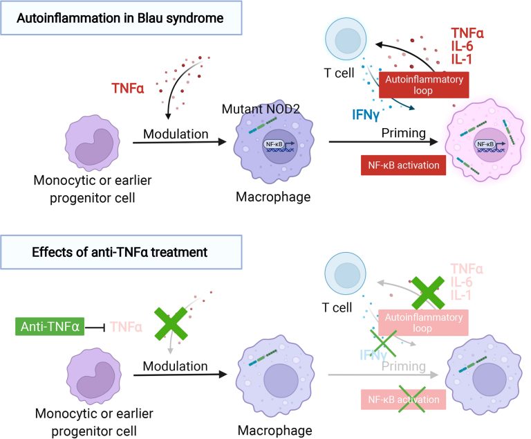 Σύνδρομο Blau