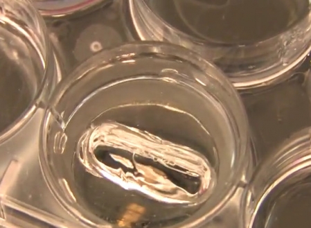 Συνθετικές φωνητικές χορδές