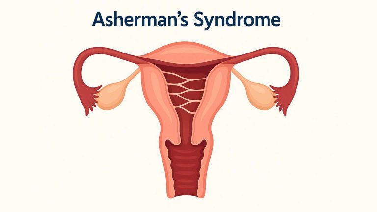 Ενδομήτριες συμφύσεις