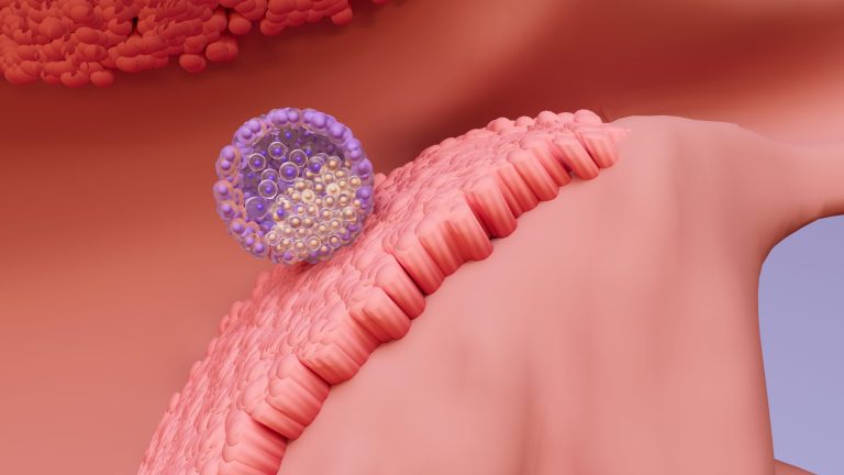 Υγιές παιδί και εξωσωματική