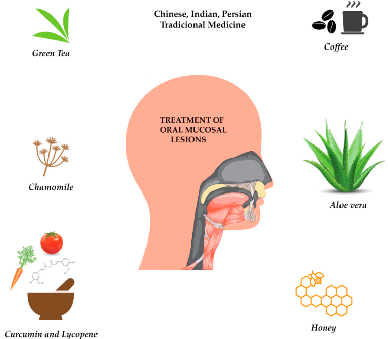 Τσάι για τη στοματίτιδα