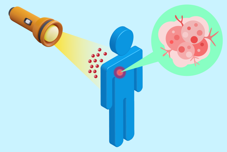 Λέιζερ για τη θεραπεία του καρκίνου μαστού