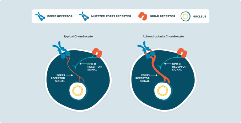 Αχονδροπλασία