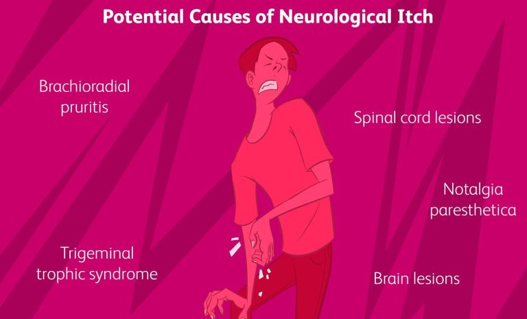 Τι λείπει από τον οργανισμό αν έχετε φαγούρα