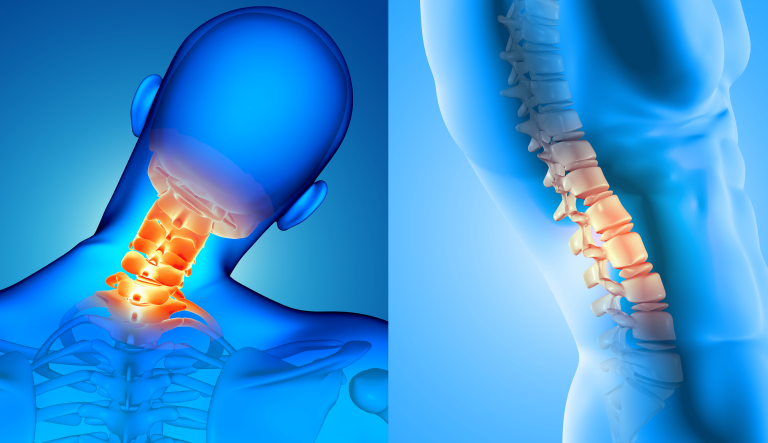 Κάκωση νωτιαίου μυελού