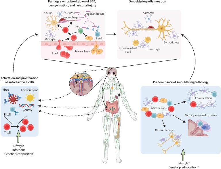 Φουμαρικός μεθυλεστέρας για τη σκλήρυνση κατά πλάκας