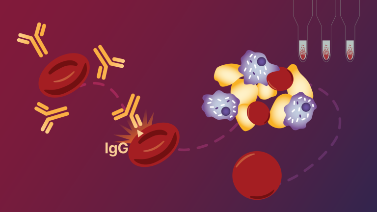 Αυτοάνοση αιμολυτική αναιμία