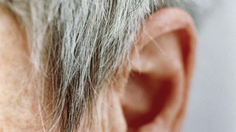 Είναι και αυτή μια θεραπεία για τα γκρίζα μαλλιά