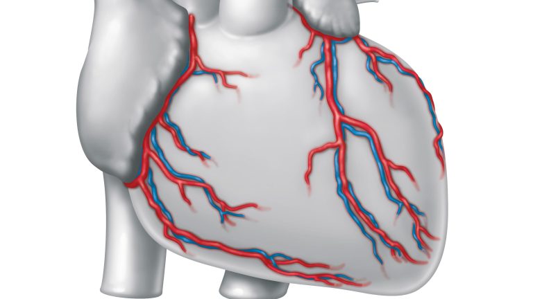 Μη αποφρακτική νόσος των στεφανιαίων αρτηριών