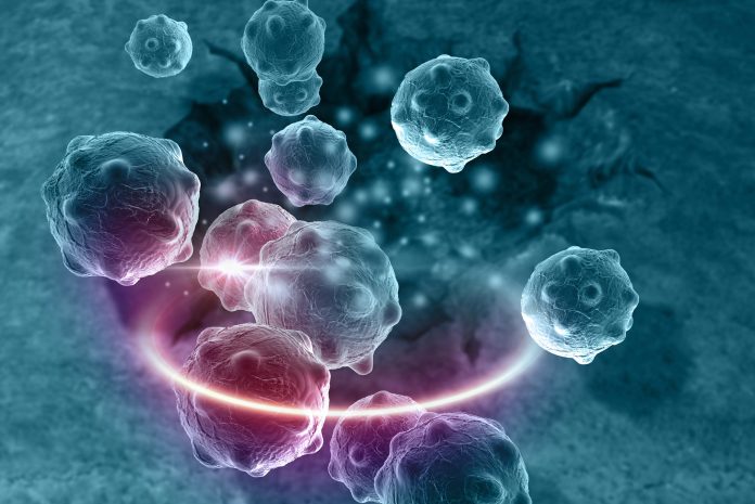 Peutz-Jeghers-syndrome-1