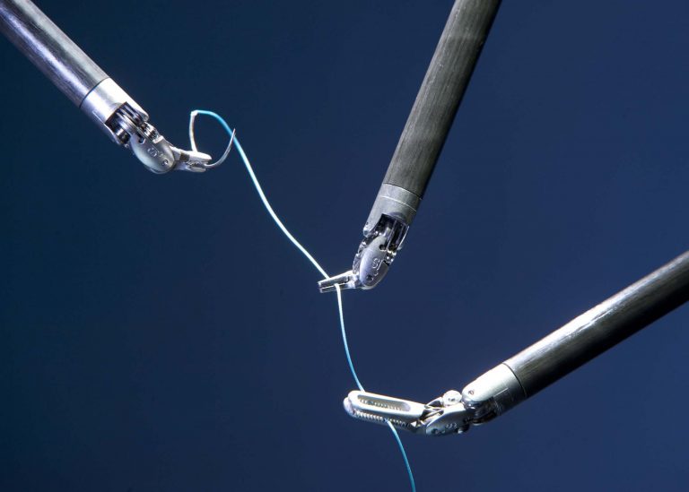 Ρομποτική χειρουργική για την ακράτεια ούρων