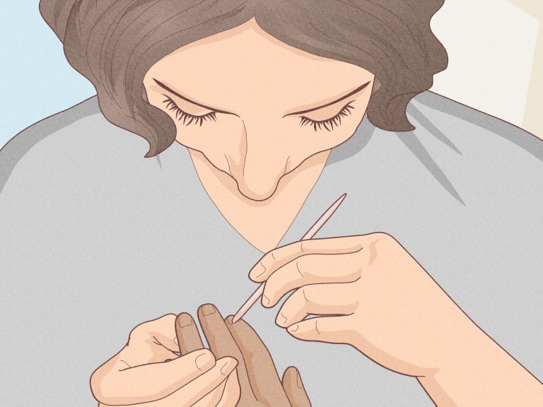 Απαλλαγείτε από τις παρανυχίδες