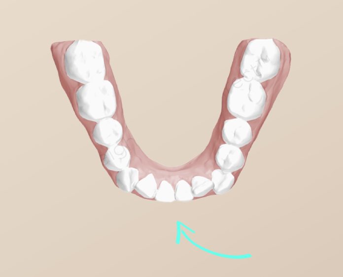 teeth-2