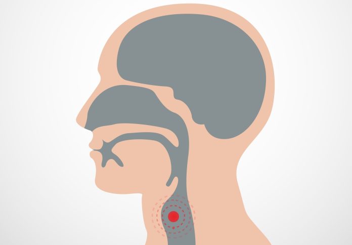 Laryngeal-Cancer-2