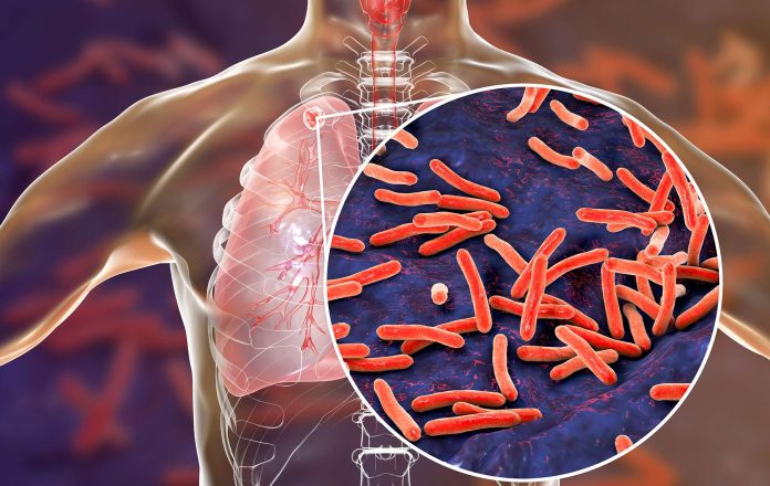 Tubercolosis-Rapid-Test-Kit-2