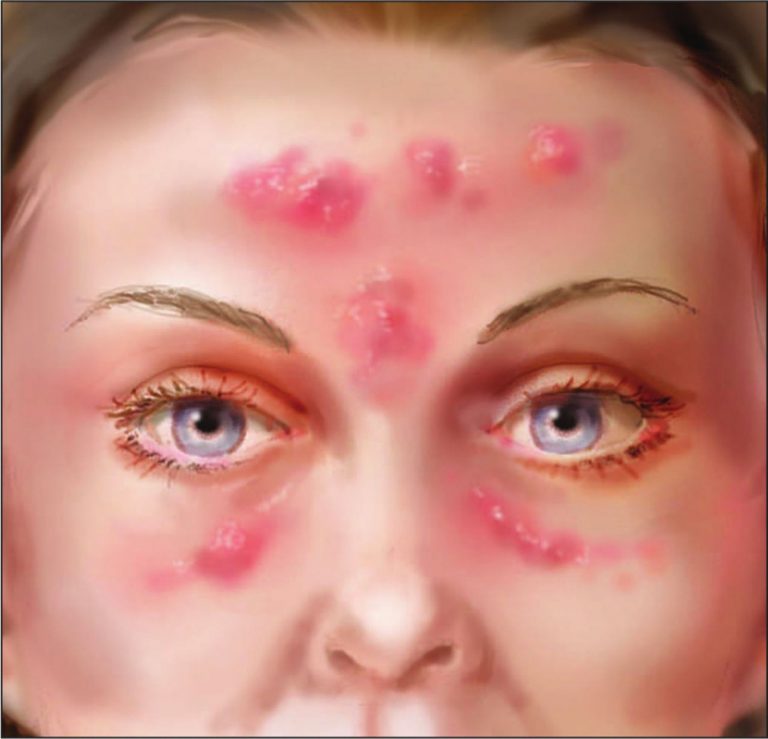 Εστίες μικροβίων στο γραφείο