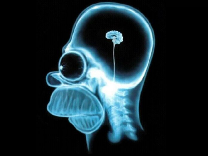 images_brain-dots-1