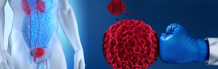 images_bladder-cancer-1