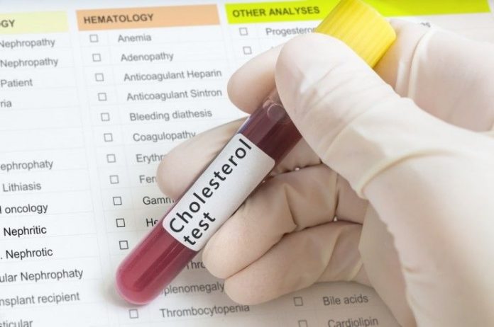 2017_octo_cholesterol-bad-1