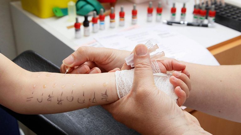 Μήπως έχετε αλλεργίες από τροφές;