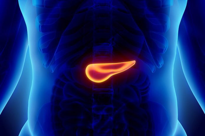 insoulinoma 1