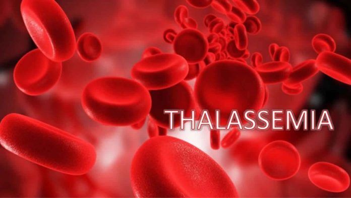 thalassemia 1