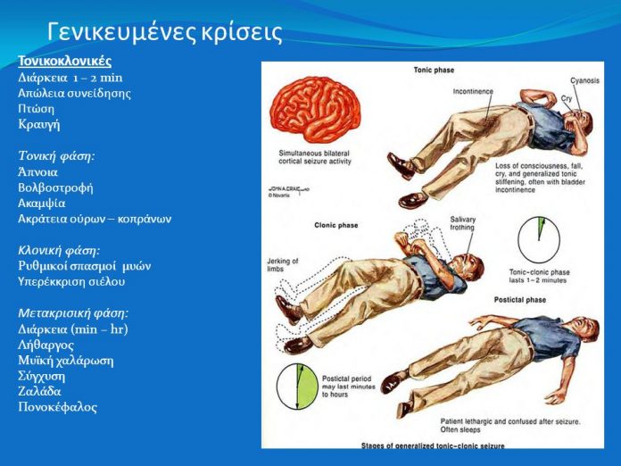Κλονικήφάση