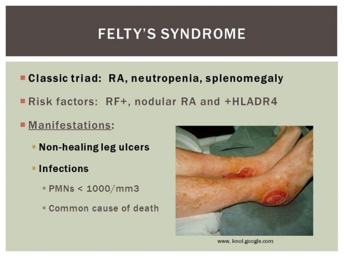 ca1b5732839480ea26c535cdaa506e9f