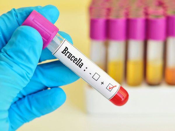 Brucellosis disease