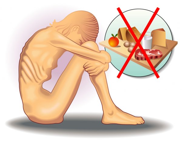 depositphotos 59877951 stock illustration illustration of girl with anorexia