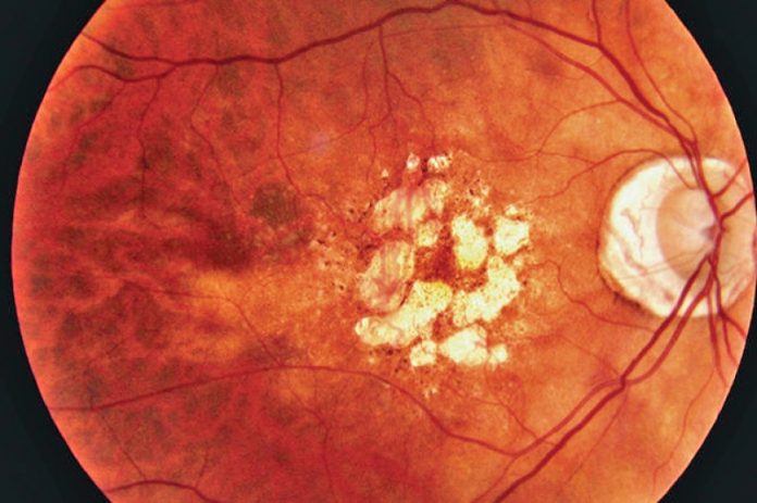 thumb 800 0 0 0 auto