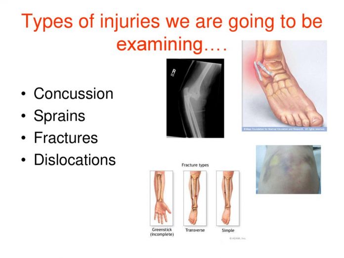 Typesofinjurieswearegoingtobeexaminingjpg
