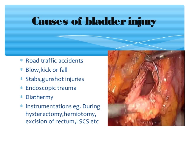 bladder injury by dhanush 3 638