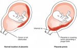 placenta