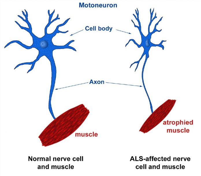 Rodent Amyotrophic Lateral Sclerosis ALS Models 1